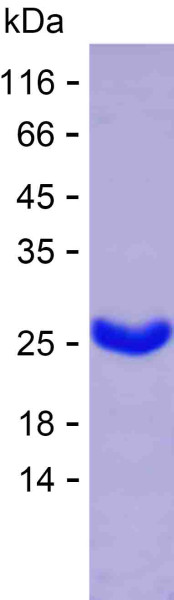 Recombinant Human LIMK2 Protein