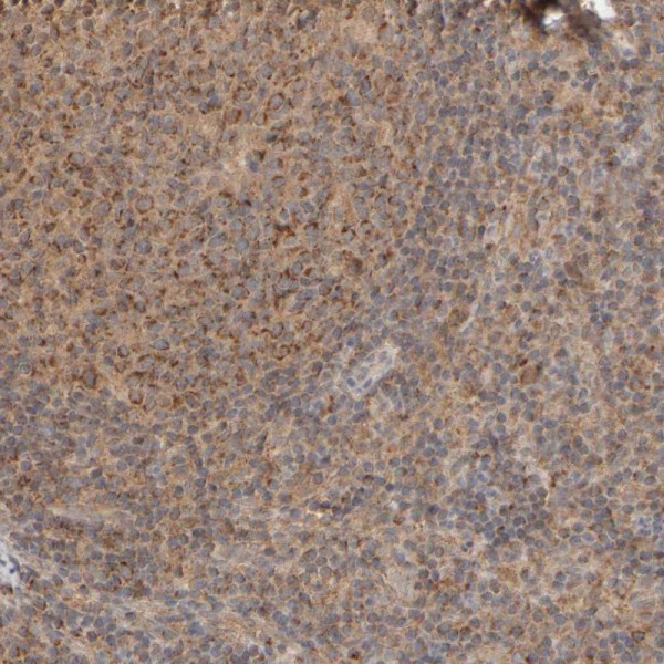 Anti-EIF2B3
