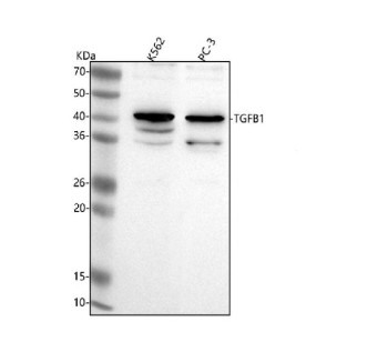 Anti-TGFB1 / Transforming growth factor beta-1