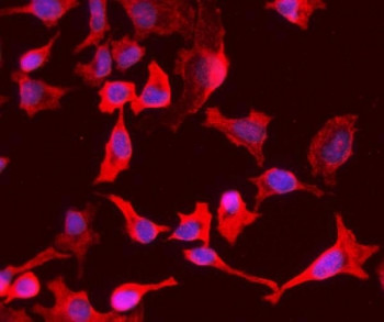 Anti-PCK1 / PEPC