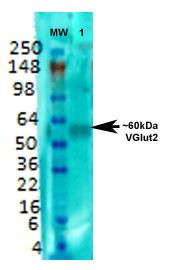 Anti-VGluT2, clone S29-29