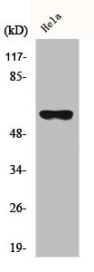 Anti-CYP27A1