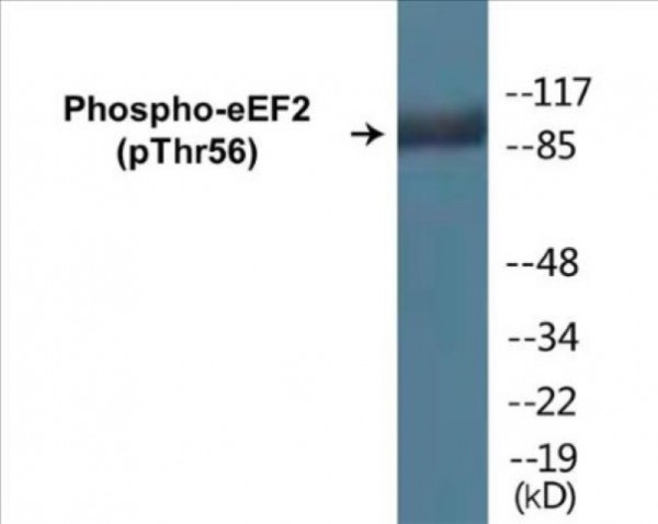 eEF2 (Phospho-Thr56) Colorimetric Cell-Based ELISA Kit