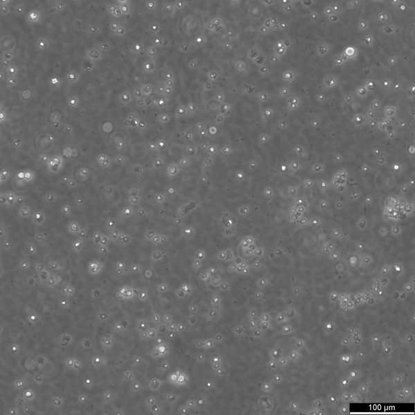 Jurkat E6.1 Cells