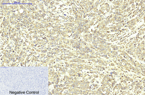 Anti-ABCB5, clone 11A2