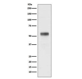 Anti-RARA / Retinoic Acid Receptor Alpha, clone GBC-18