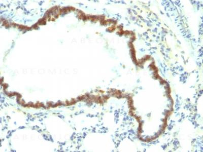 Anti-Ep-CAM / CD326 (Rat) (Epithelial Marker)(Clone: Epcam/1158)
