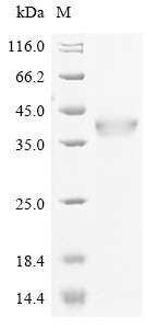 Integrin alpha-M (ITGAM), partial, human, recombinant