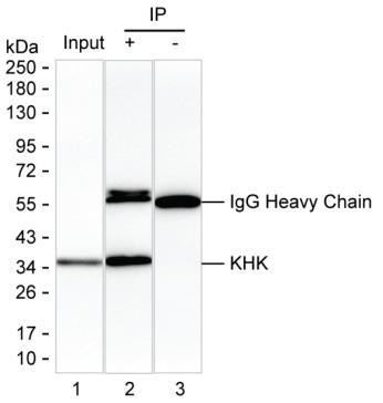 KHK antibody
