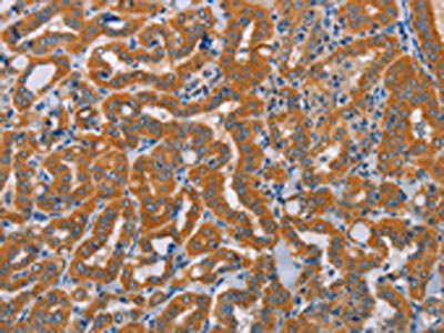 Anti-ALDH3A1