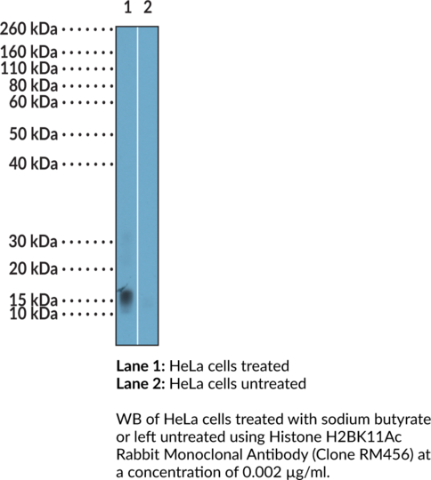 Anti-Histone H2BK11Ac Rabbit (Clone RM456)