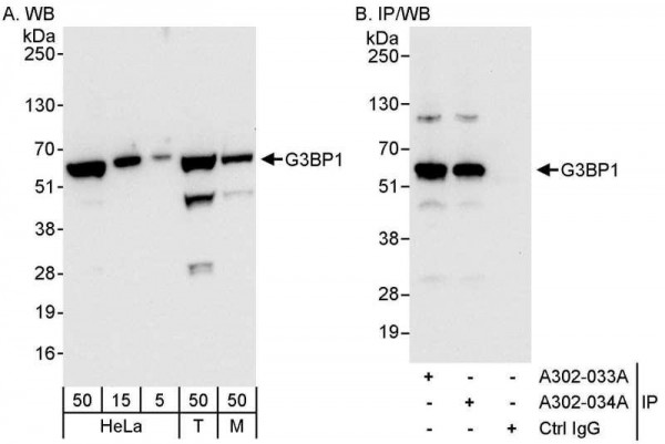 Anti-G3BP1