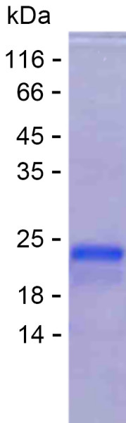 Recombinant Human PUM3 Protein