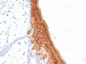 Anti-Cytokeratin 10 (KRT10) (Suprabasal Epithelial Marker) Recombinant Mouse Monoclonal Antibody (cl
