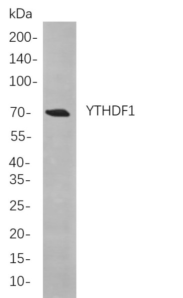 Anti-Recombinant YTHDF1, clone 1A6