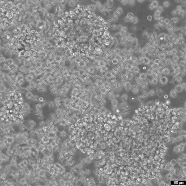 CESS Cells
