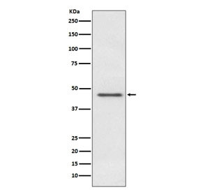 Anti-PDHA1 / Pyruvate Dehydrogenase E1 Alpha, clone AODI-16