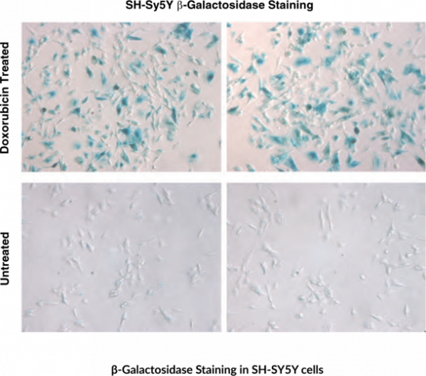 SenescenceAssociated betaGalactosidase Staining Kit Cayman Chemical