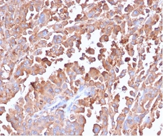Anti-Carcinoembryonic Antigen (CEA) / CD66, recombinant antibody, clone C66/6470R