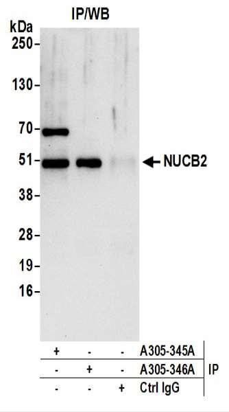 Anti-NUCB2