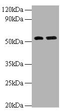 Anti-MMP12
