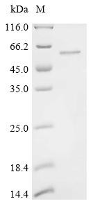 Methyltransferase-like protein 17, mitochondrial (METTL17), human, recombinant