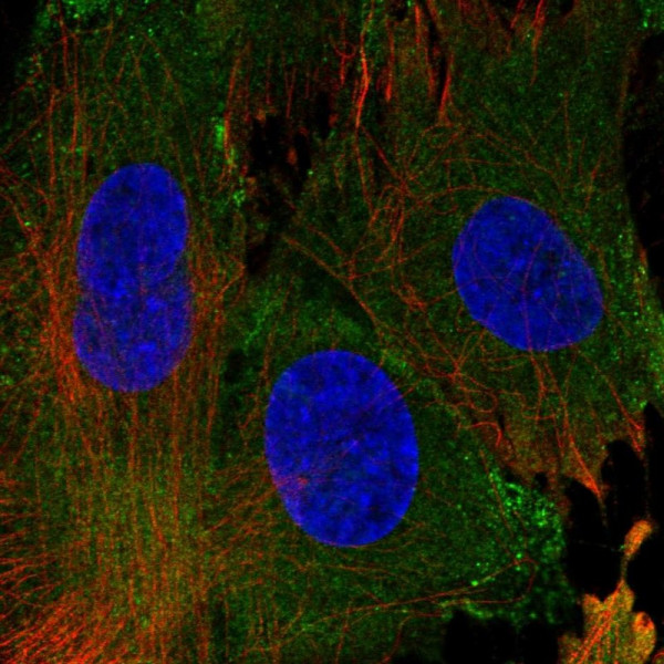 Anti-EHD1