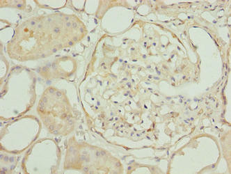 Anti-EPM2AIP1