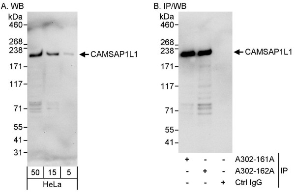 Anti-CAMSAP1L1