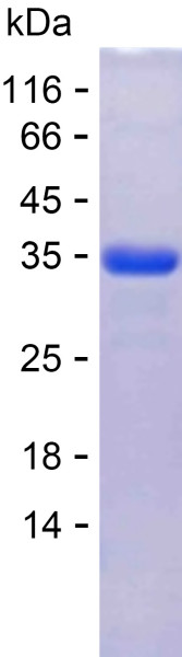 Recombinant Human KIAA1549 Protein