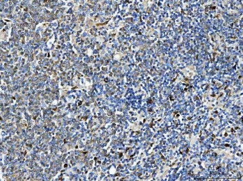 Anti-ARHGAP45 / Rho GTPase-activating protein 45