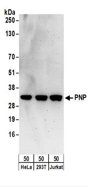 Anti-PNP