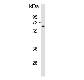 Anti-MTMR9 / Myotubularin-related protein 9
