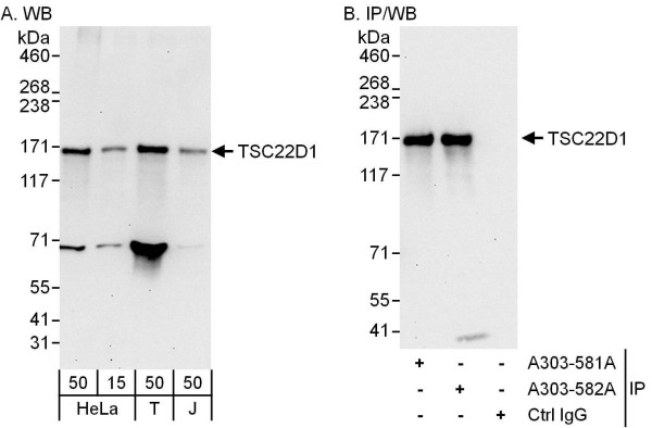 Anti-TSC22D1