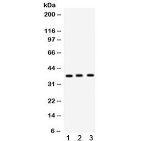 Anti-Surfactant protein D
