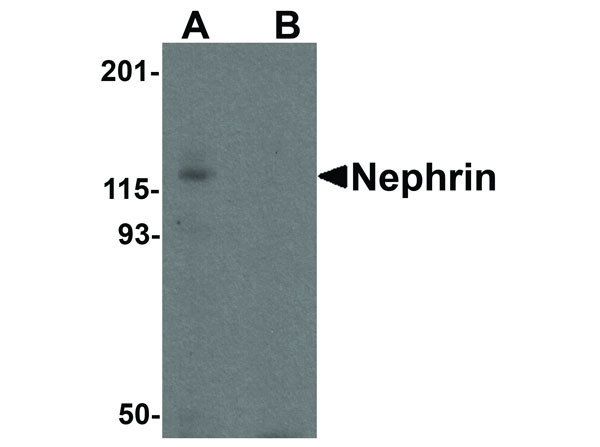 Anti-Nephrin