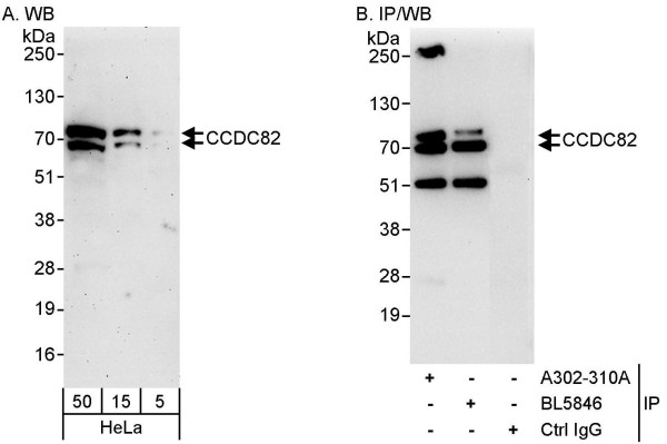 Anti-CCDC82
