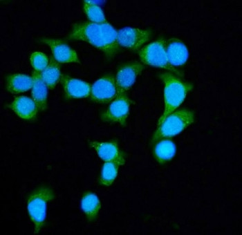 Anti-DIAPH1 / Diaphanous Homolog 1