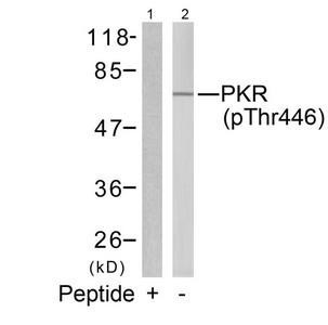 Anti-phospho-EIF2AK2 (Thr446)