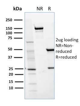 Anti-CD36 (Platelet &amp; Microvessel Marker), clone GPIIIb/1654