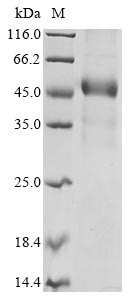 Disco-interacting protein 2 homolog C (DIP2C), partial, human, recombinant