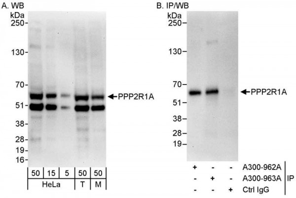 Anti-PPP2R1A