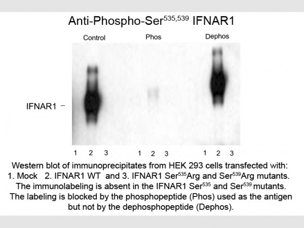 Anti-phospho-Interferon alpha Receptor Type I (Ser535/Ser539)