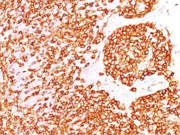 Anti-CD45 / LCA (B-Cell Marker) Monoclonal Antibody (Clone: rPTPRC/1460)