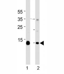 Anti-Myoglobin, clone 773CT18.2.2