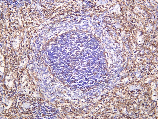 Anti-Recombinant SIRP-alpha1, clone C112248
