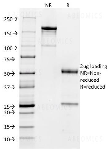 Anti-CD32 (Fc Gamma RIIa) Monoclonal Antibody (Clone: FCGR2A/479)
