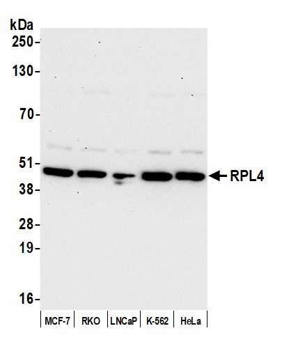 Anti-RPL4/Ribosomal Protein L4