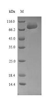 Sprouty-related, EVH1 domain-containing protein 1 (SPRED1), human, recombinant