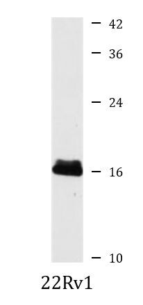 Anti-PFDN2